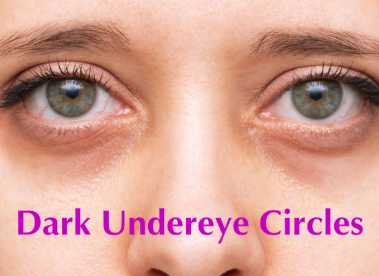 What do dark circles underneath your eyes mean?